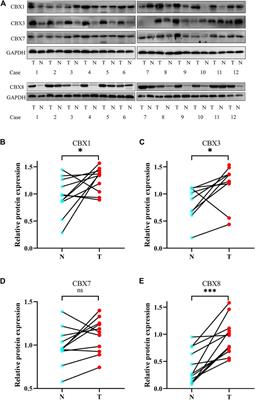 Identification and Validation of Chromobox Family Members as Potential Prognostic Biomarkers and Therapeutic Targets for Human Esophageal Cancer